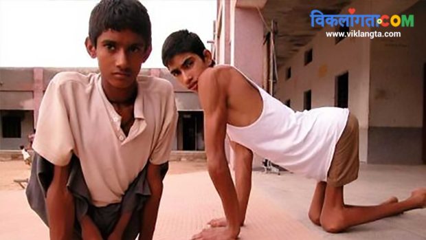 locomotor disability India polio affected youngsters